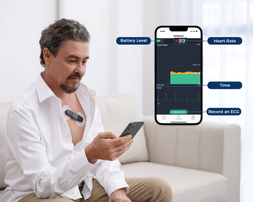 24Hour ECG Monitor with AI Analysis Screen for Heart Problems All